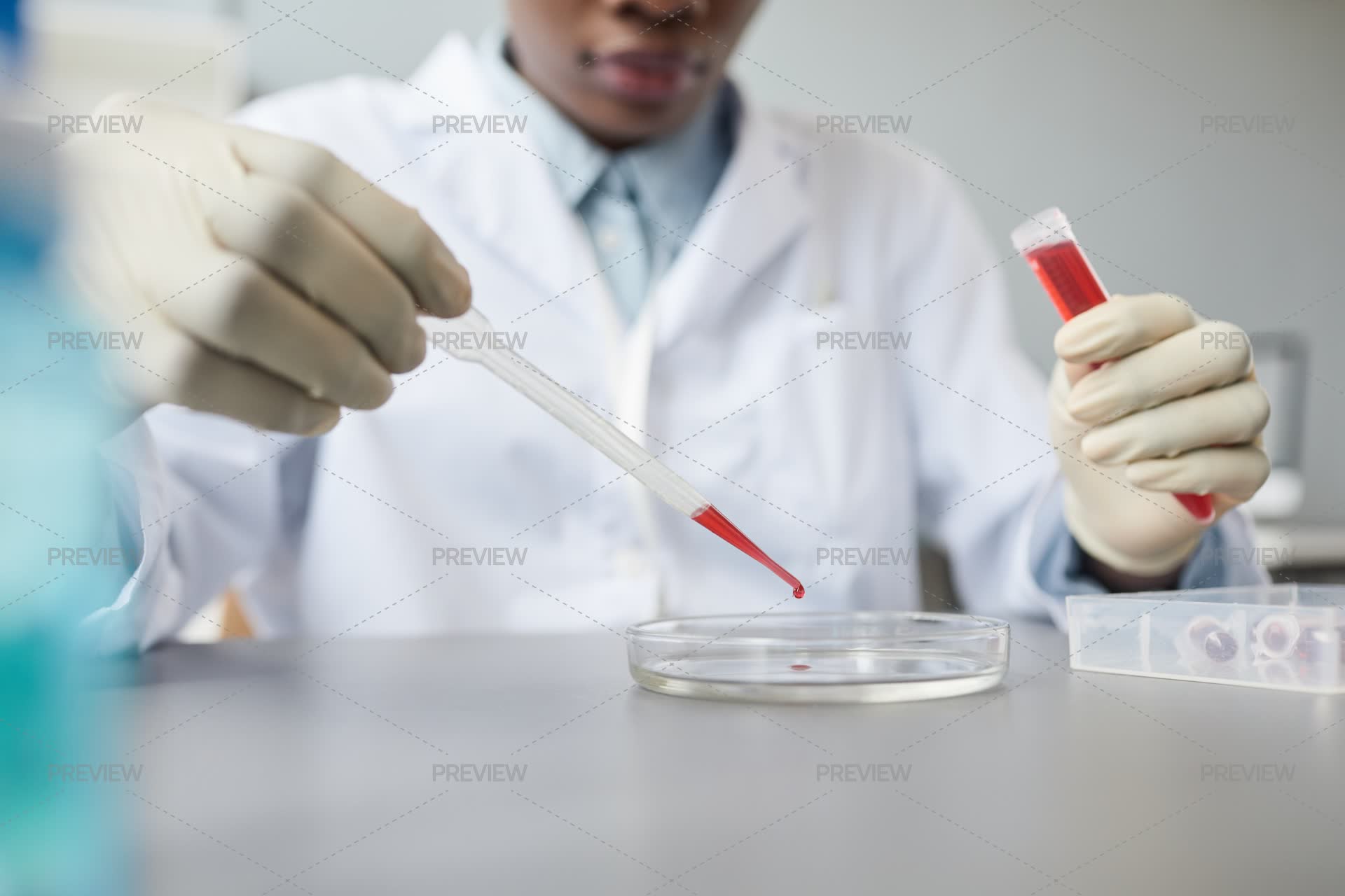 Woman Put Blood Sample With Pipette Into A Petri Dish For Testing ...